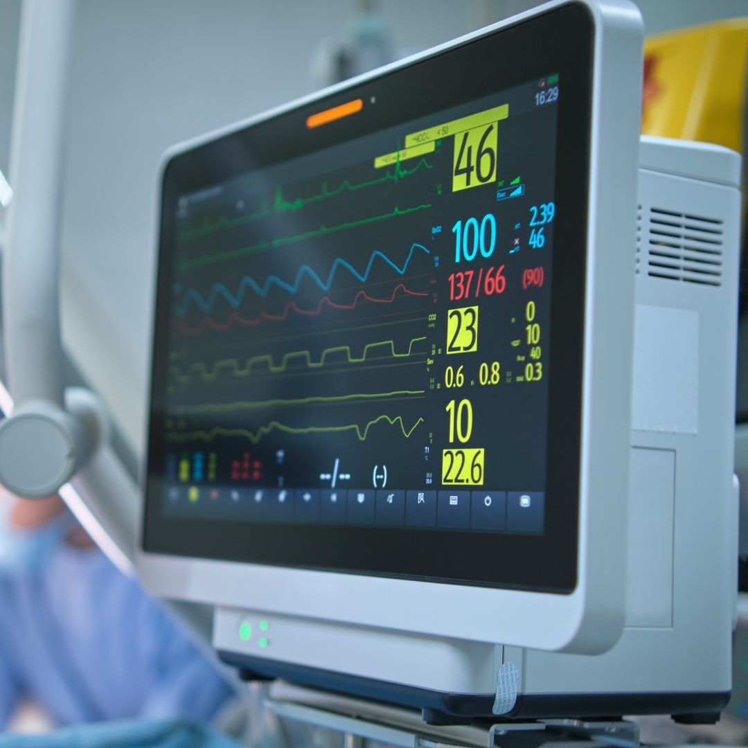 ECG (Electrocardiogram)