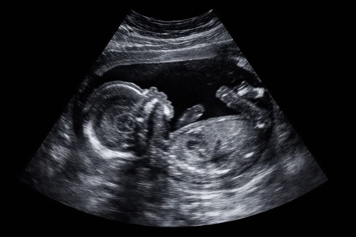 USG (Ultrasonography)